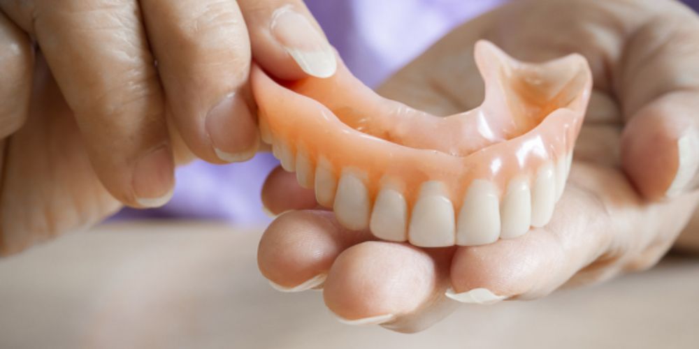 Fixed partial dentures