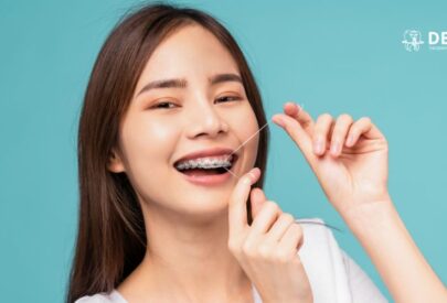 Braces in Delhi