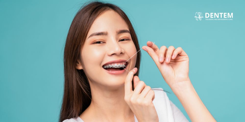 Braces in Delhi