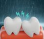 Monsoon Weather Affects Your Teeth and Gums  90x80