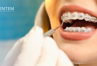 Orthodontist in Delhi