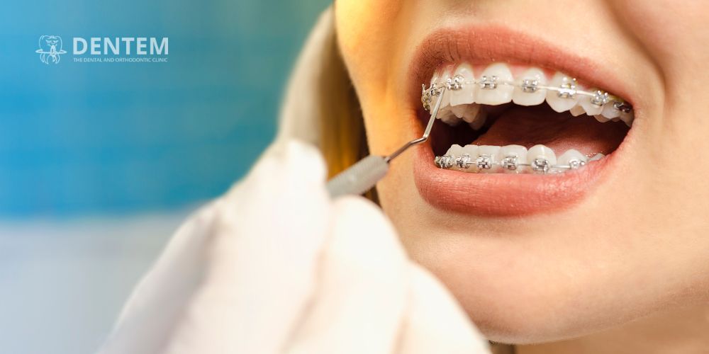Orthodontist in Delhi