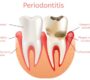 Periodontist 1 90x80