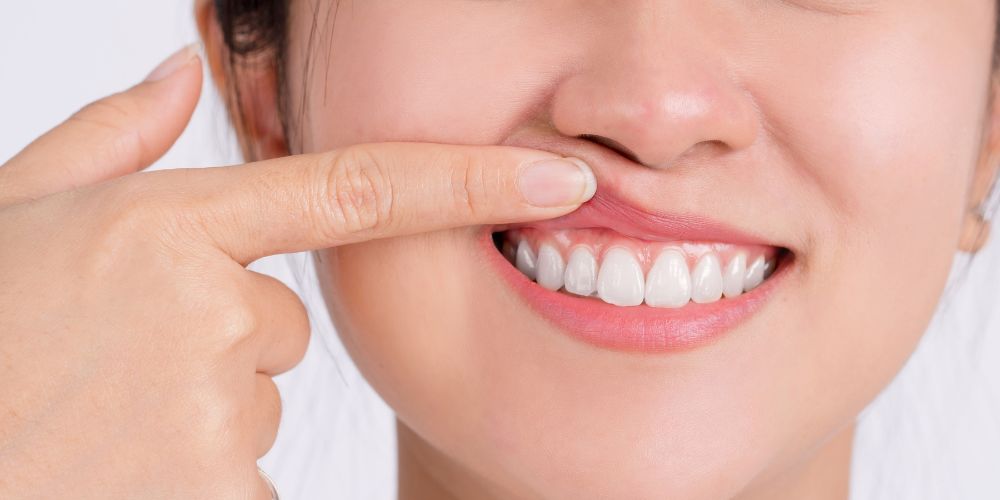 Periodontist in Delhi