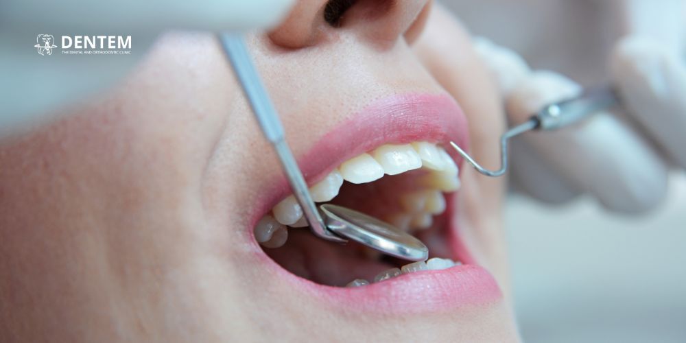 Dentist in Delhi