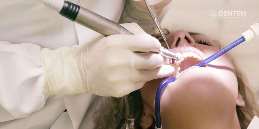 Dentist in Delhi