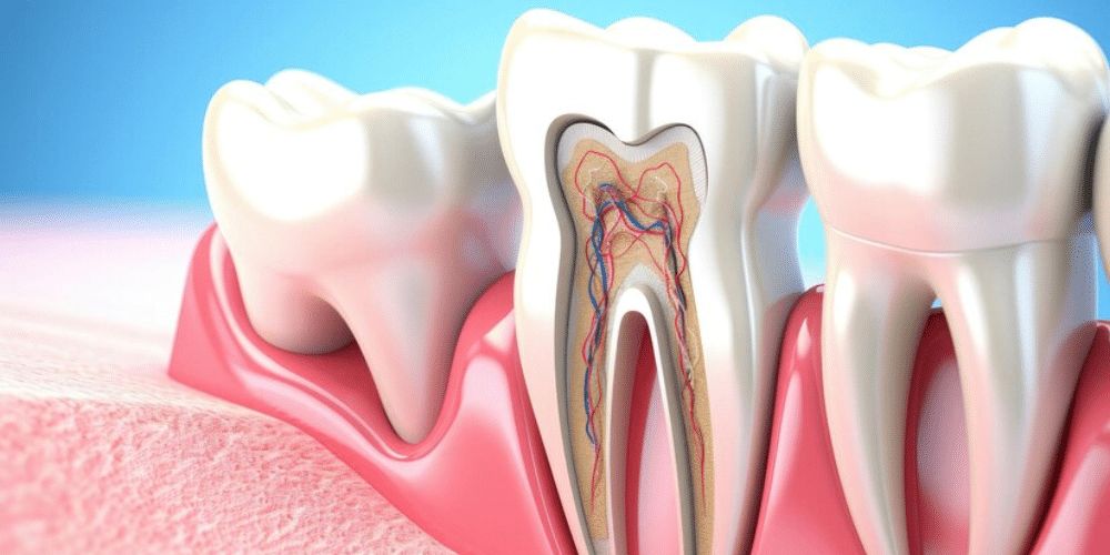 Root Canal Treatment in Delhi
