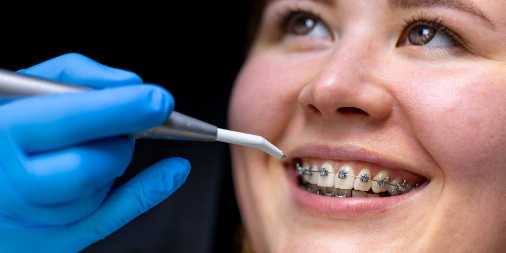 Orthodontist in Delhi