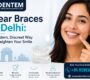 Clear braces in Delhi 90x80