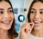 Braces vs Aligners 90x80