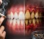 Dentist in Delhi 2 90x80