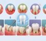 Dentist in Delhi 5 90x80