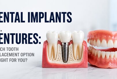 Dental Implants