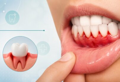 Dentist in Delhi