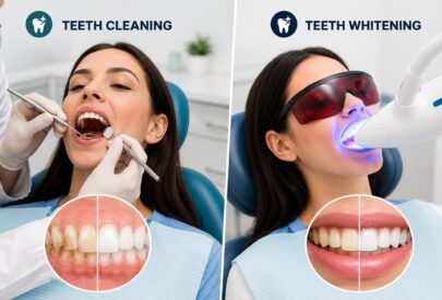 Teeth Whitening