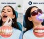 Teeth Whitening 90x80