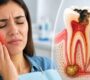 Tooth Infection 1 90x80