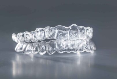 Aligners