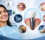 Dental Implant 90x80