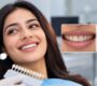 Smile Makeover 90x80