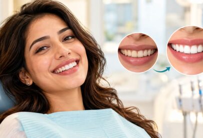 How Much Does It Cost for a Full Smile Makeover in Delhi?