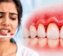 dentist in delhi 2 90x80