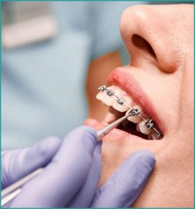 Orhtodontist in South Dlehi