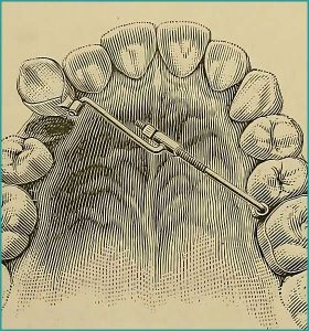 History of Orthodontics
